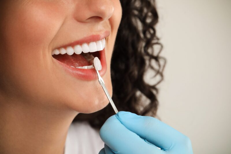 Dental Crowns and Bridges Katy